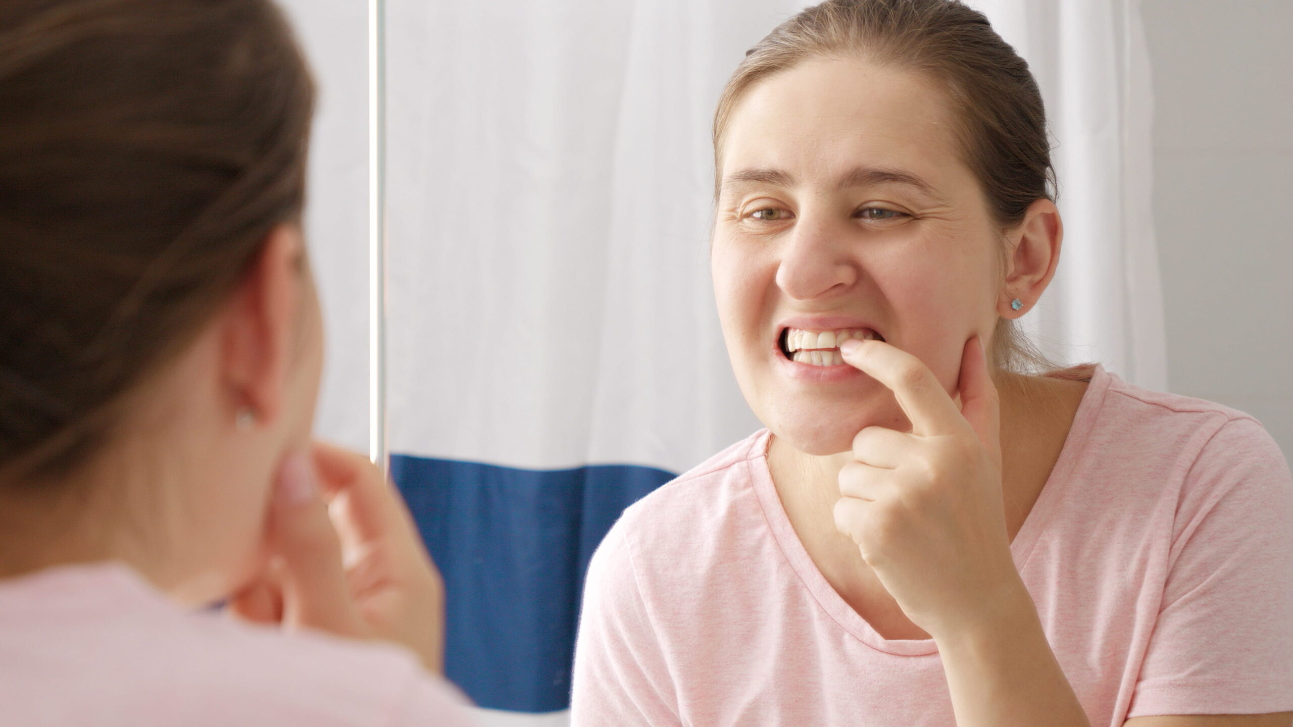 5 Common Causes of Tooth Discoloration